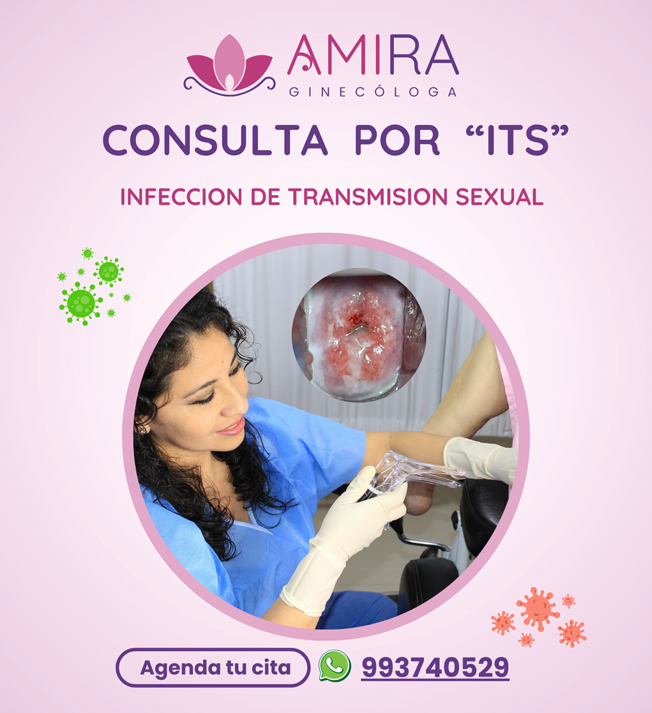 Amira Ginecologa Obstetra - Consulta por ITS