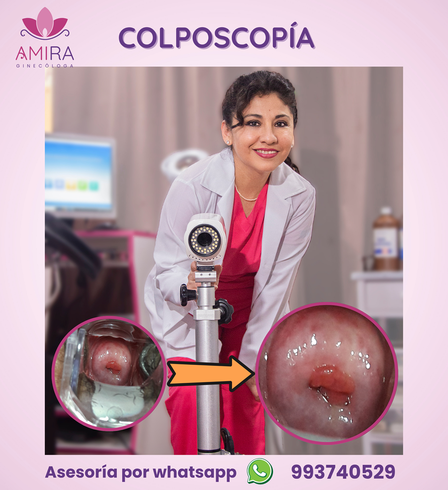 Amira Ginecologa Obstetra - Colposcopia