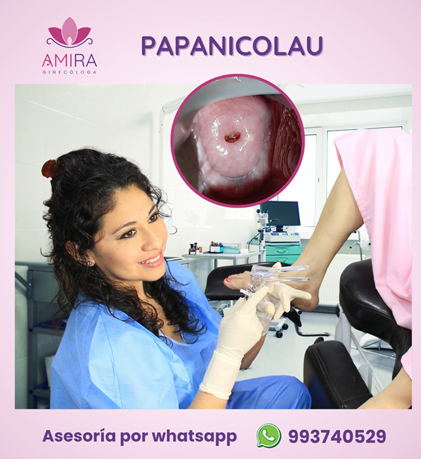 Amira Ginecologa Obstetra - Papanicolau