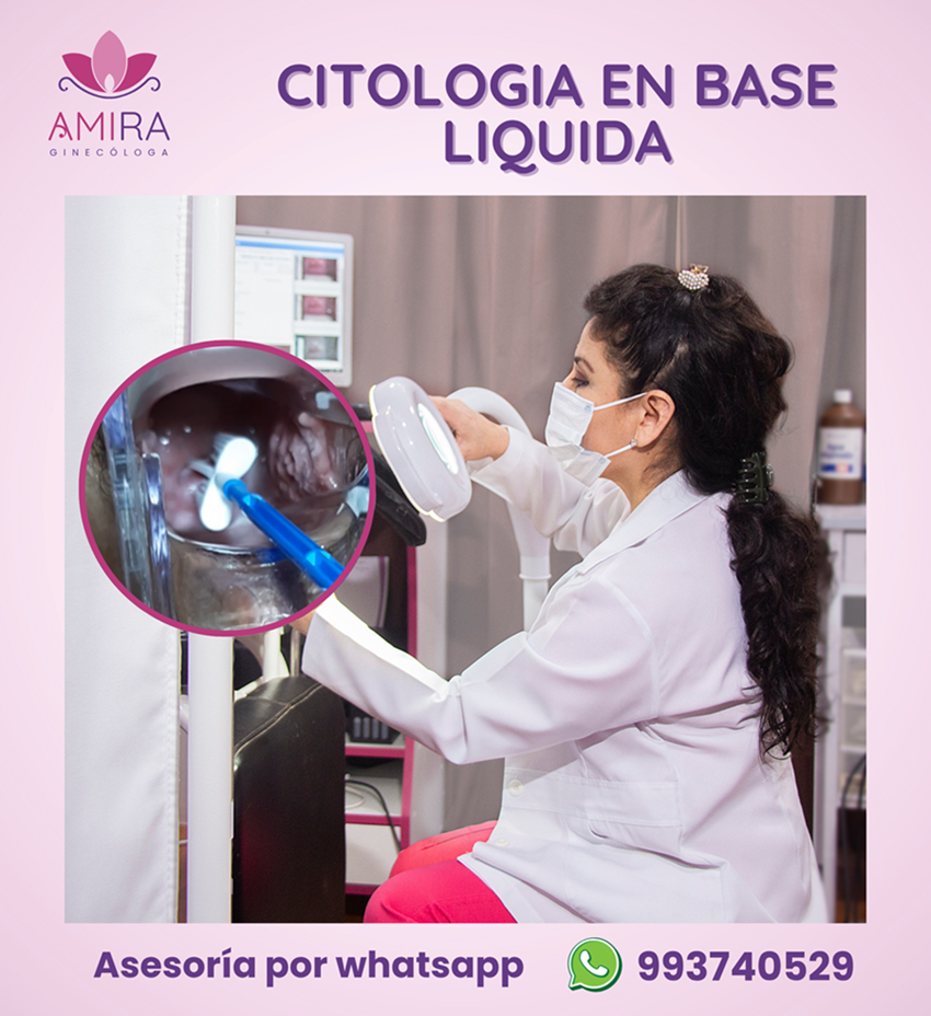Amira Ginecologa Obstetra - Citologia en Base Liquida