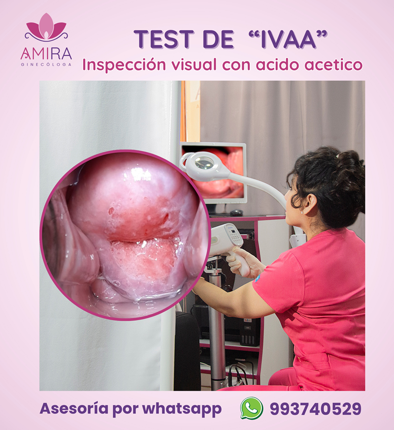 Amira Ginecologa Obstetra - Prueba del  IVAA