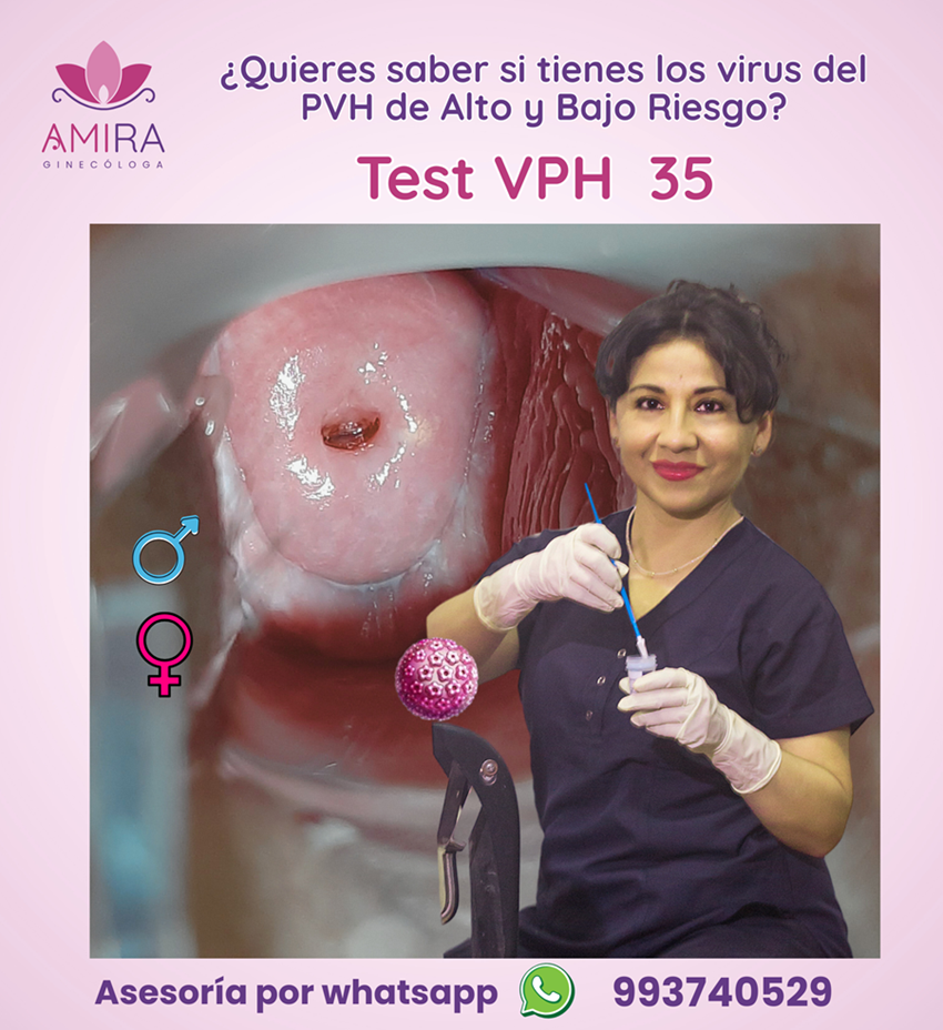 Amira Ginecologa Obstetra - PVH 35 para detectar virus de Alto y bajo Riesgo