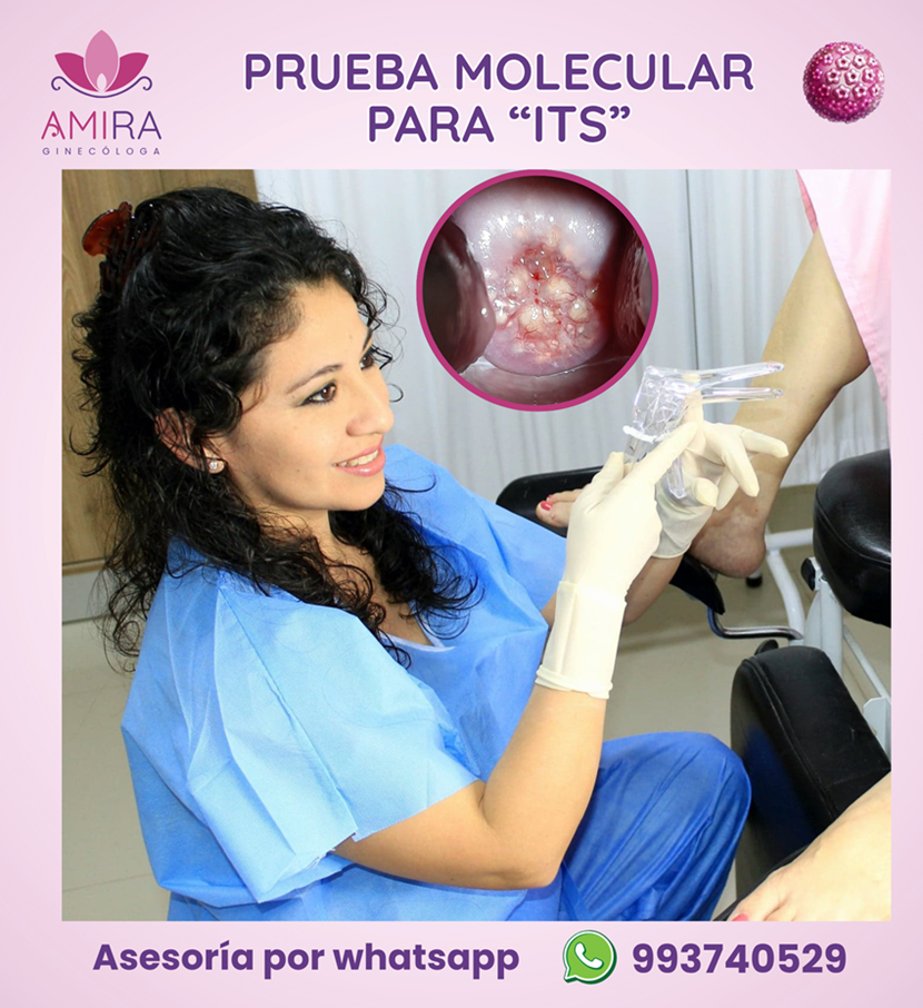 Amira Ginecologa Obstetra - Prueba Molecular para  ITS