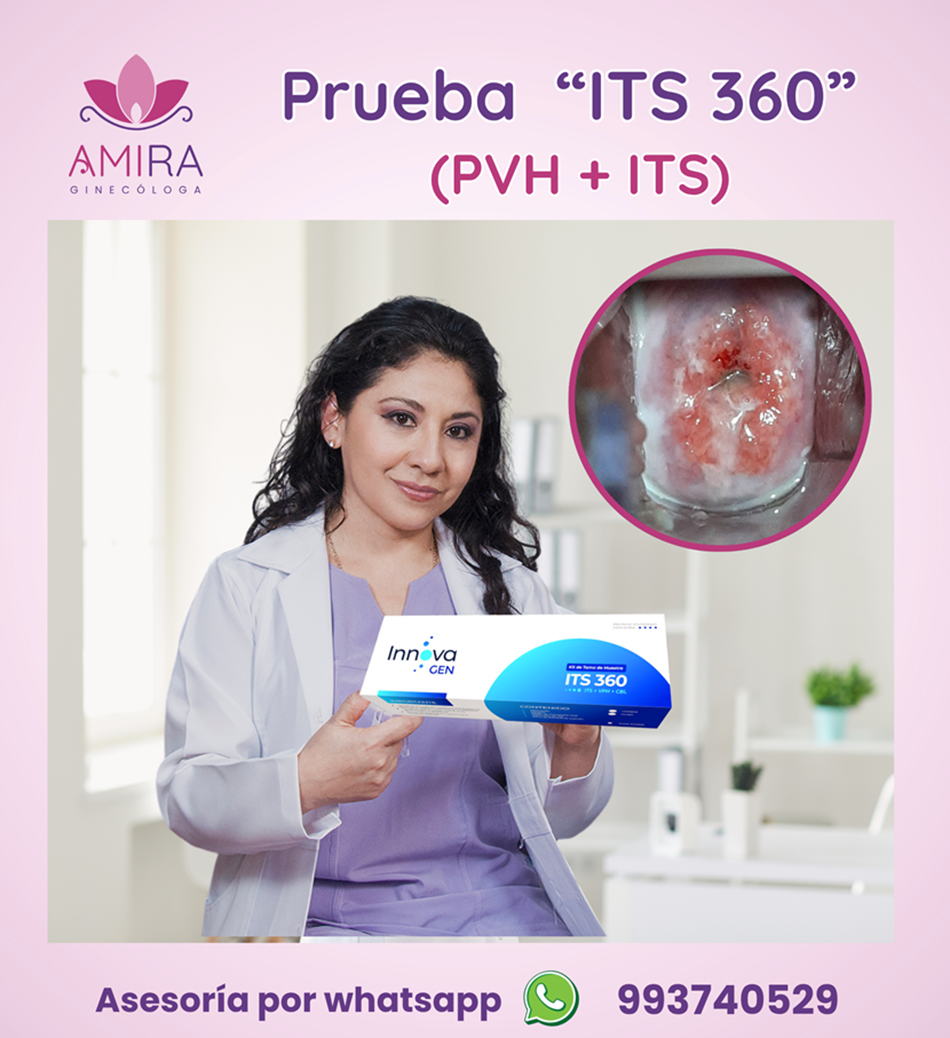 Amira Ginecologa Obstetra - Prueba  "ITS 360"  (PVH + ITS)
