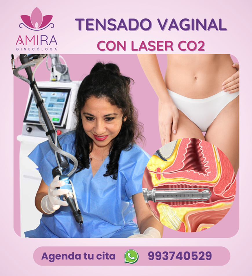 Amira Ginecologa Obstetra - TENSADO VAGINAL