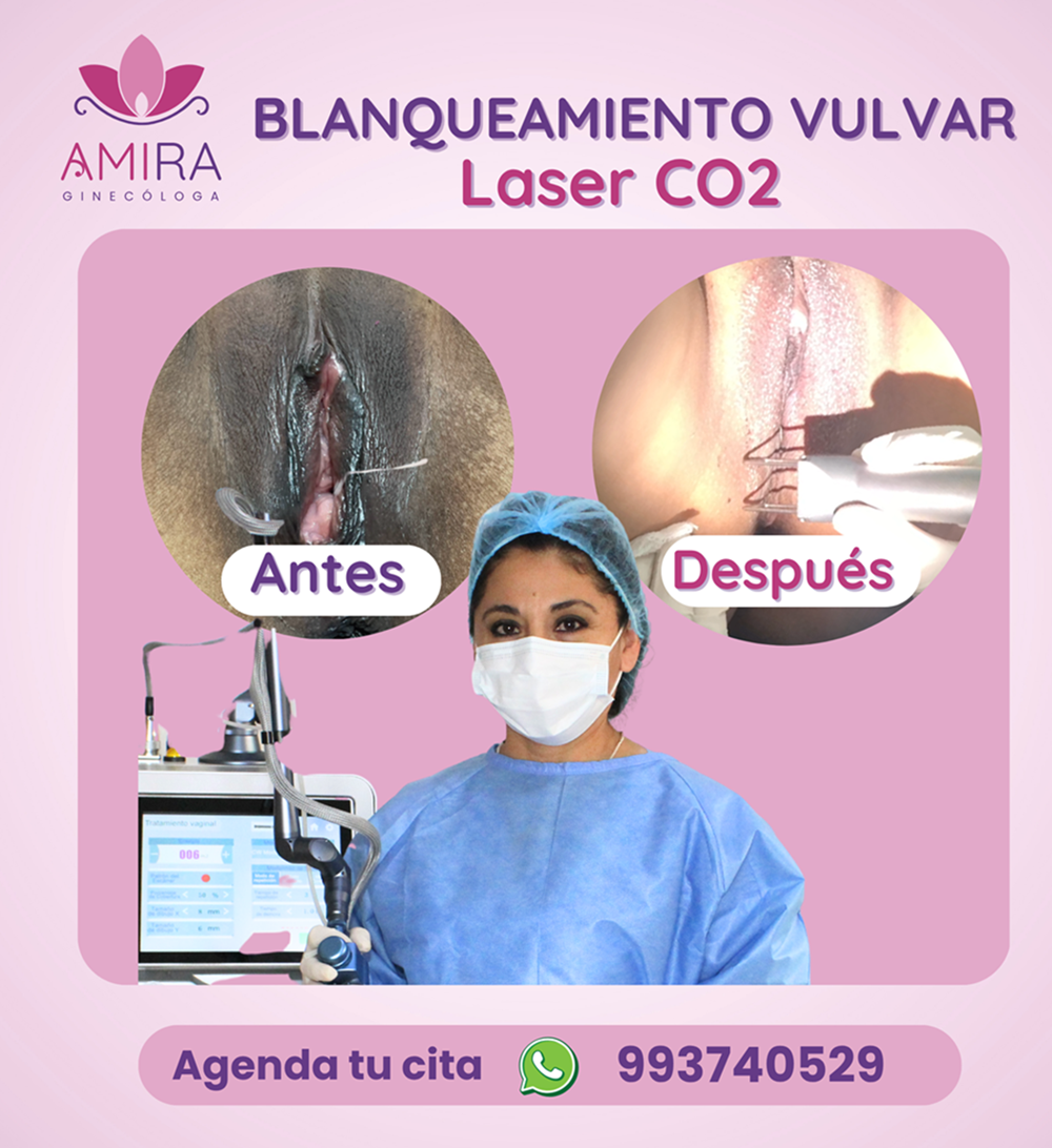 Amira Ginecologa Obstetra - BLANQUEAMIENTO  VULVAR