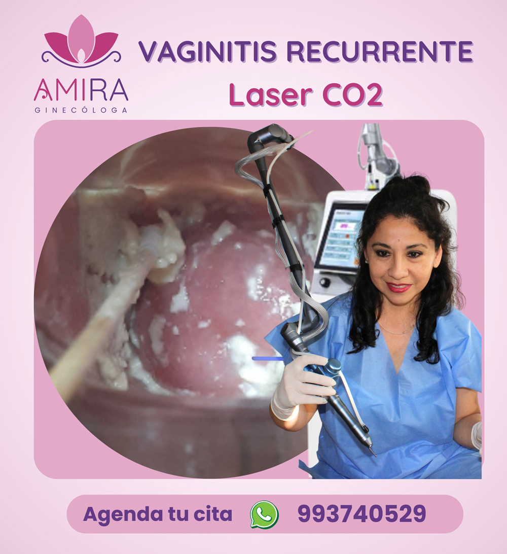 Amira Ginecologa Obstetra - VAGINITIS RECURRENTE