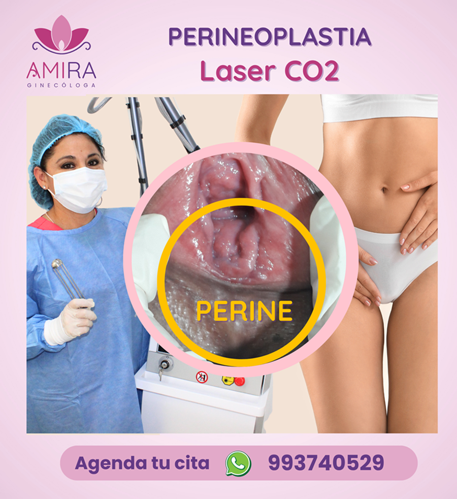 Amira Ginecologa Obstetra - PERINEOPLASTIA