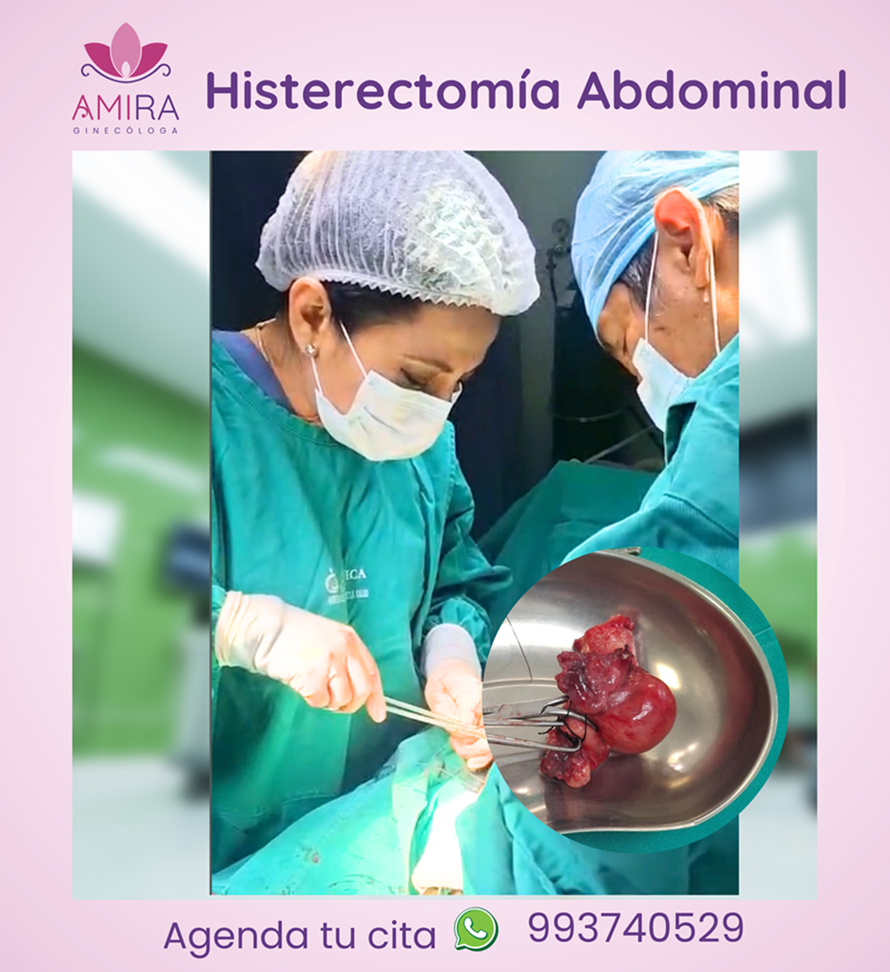 Amira Ginecologa Obstetra - HISTERECTOMIA ABDOMINAL
