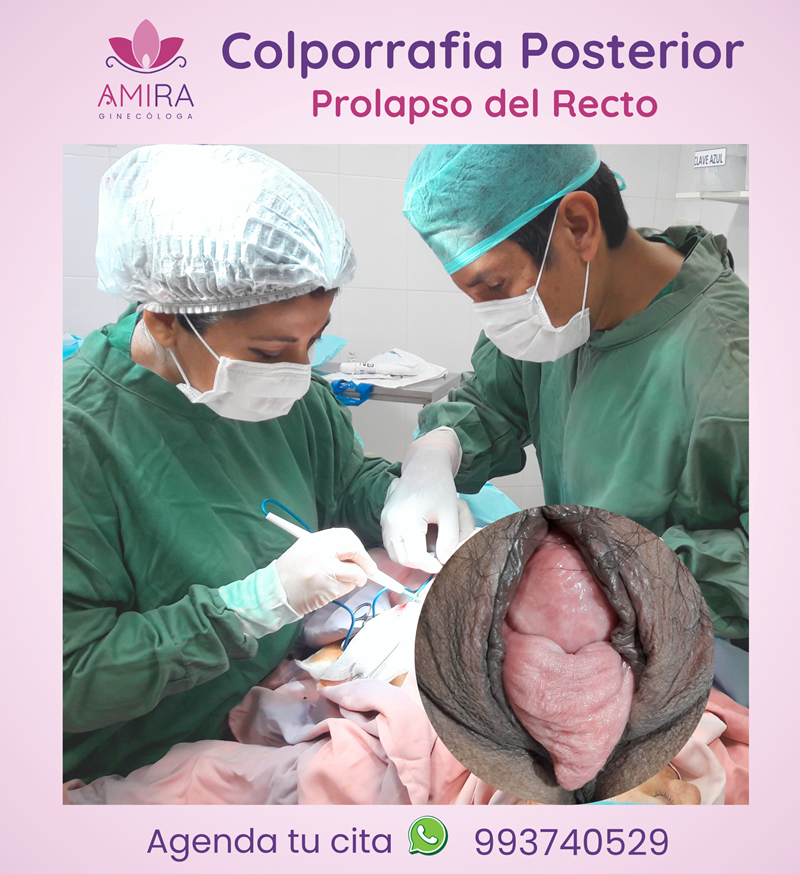 Amira Ginecologa Obstetra - COLPORRAFIA   POSTERIOR